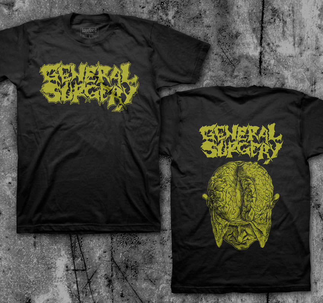 GENERAL_SURGERY_Gold_Brain_T_shirt_Front_in_Australia_Global_Disrupt_Records